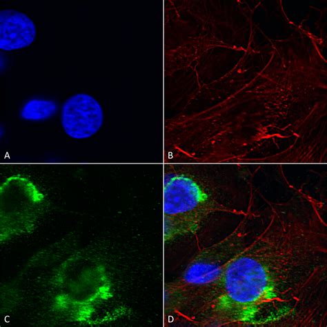 ofgfap|Glial Fibrillary Acidic Protein: GFAP